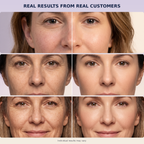 Bakuchiol Anti-Aging Face Serum